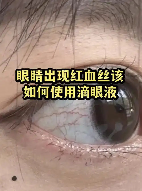 KPL春季赛前瞻：新版本“视野之眼”降临，这位冷门射手或将封神